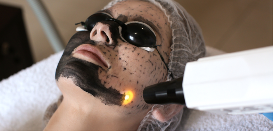 Hollywood Peel